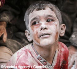 Syrian boy in Aleppo covered in white dust